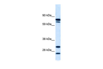 ZNF606 Rabbit Polyclonal Antibody