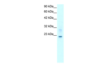 CLDN9 Rabbit Polyclonal Antibody