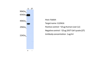 CLDN16 Rabbit Polyclonal Antibody