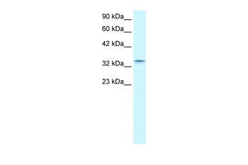 CLDN16 Rabbit Polyclonal Antibody