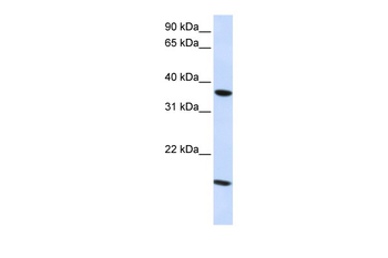 CLDN16 Rabbit Polyclonal Antibody