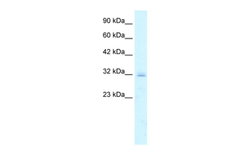 CLDN15 Rabbit Polyclonal Antibody