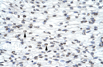 LHX3 Rabbit Polyclonal Antibody