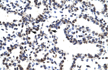 LHX3 Rabbit Polyclonal Antibody