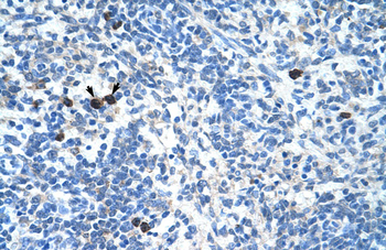 MAFB Rabbit Polyclonal Antibody