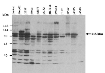 ST18 Rabbit Polyclonal Antibody