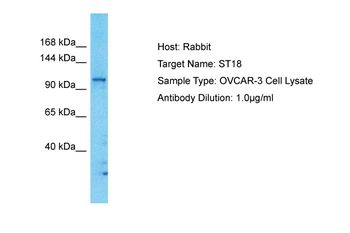 ST18 Rabbit Polyclonal Antibody