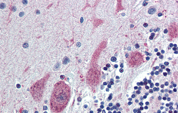 ST18 Rabbit Polyclonal Antibody