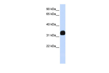 MED27 Rabbit Polyclonal Antibody