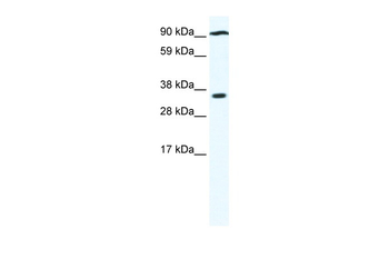 PARP16 Rabbit Polyclonal Antibody