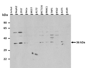 PARP16 Rabbit Polyclonal Antibody