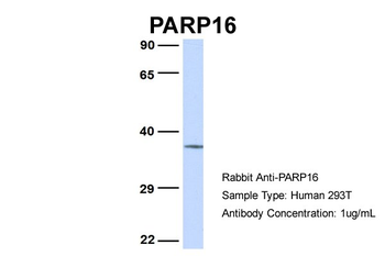 PARP16 Rabbit Polyclonal Antibody