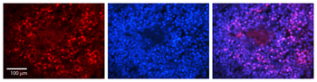 PARP11 Rabbit Polyclonal Antibody