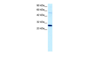 PARP11 Rabbit Polyclonal Antibody