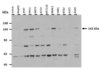 TNKS Rabbit Polyclonal Antibody