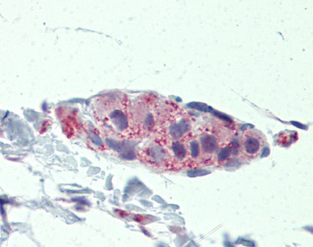 TNKS Rabbit Polyclonal Antibody