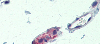 TNKS Rabbit Polyclonal Antibody