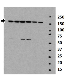 TNKS Rabbit Polyclonal Antibody