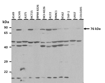 TIPARP Rabbit Polyclonal Antibody