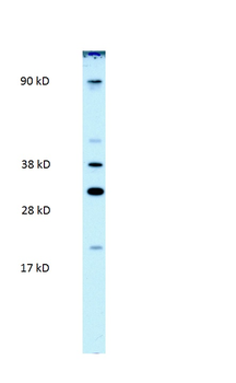 PARP11 Rabbit Polyclonal Antibody