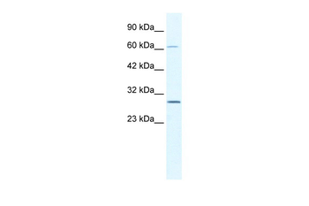 PARP11 Rabbit Polyclonal Antibody