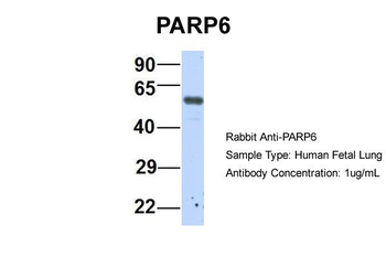 PARP6 Rabbit Polyclonal Antibody
