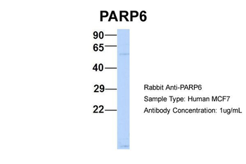 PARP6 Rabbit Polyclonal Antibody