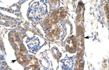 SLC17A2 Rabbit Polyclonal Antibody