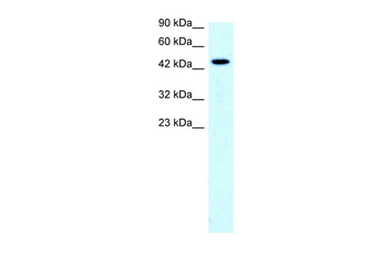 SLC17A2 Rabbit Polyclonal Antibody
