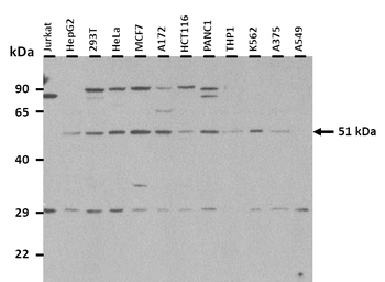 XK Rabbit Polyclonal Antibody