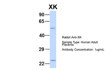 XK Rabbit Polyclonal Antibody