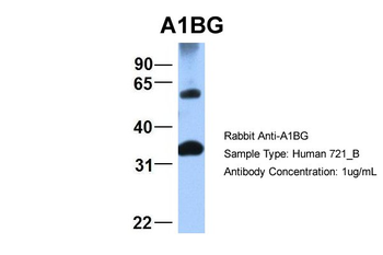A1BG Rabbit Polyclonal Antibody