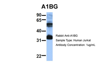 A1BG Rabbit Polyclonal Antibody