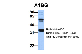 A1BG Rabbit Polyclonal Antibody