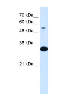 A1BG Rabbit Polyclonal Antibody