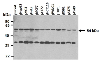 A1BG Rabbit Polyclonal Antibody