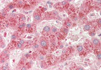 A1BG Rabbit Polyclonal Antibody