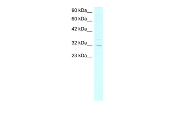 ASGR2 Rabbit Polyclonal Antibody