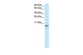 FABP7 Rabbit Polyclonal Antibody