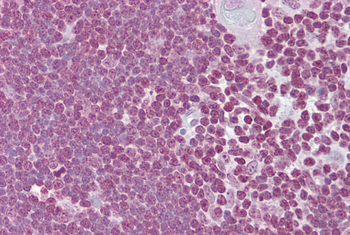 CD40LG Rabbit Polyclonal Antibody