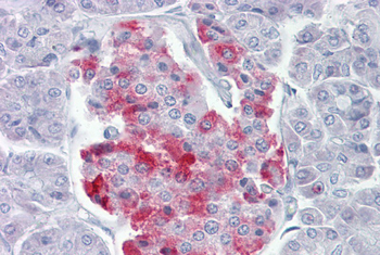 PCSK1 Rabbit Polyclonal Antibody
