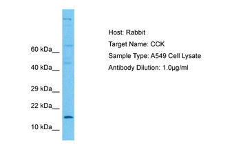 CCK Rabbit Polyclonal Antibody