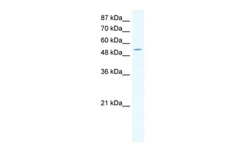 CPA1 Rabbit Polyclonal Antibody