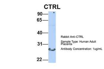 CTRL Rabbit Polyclonal Antibody
