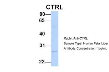 CTRL Rabbit Polyclonal Antibody