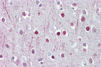 CNP Rabbit Polyclonal Antibody