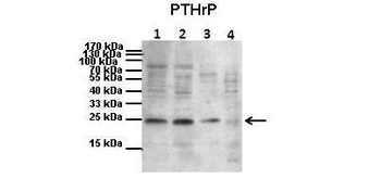PTHLH Rabbit Polyclonal Antibody