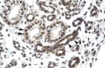 PTHLH Rabbit Polyclonal Antibody