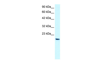 PTHLH Rabbit Polyclonal Antibody