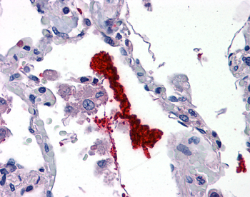 KLK6 Rabbit Polyclonal Antibody